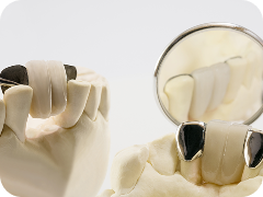 Dental Crowns