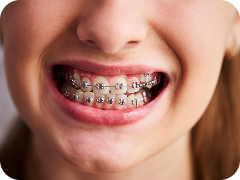 Orthodontics (Braces and Invisalign)