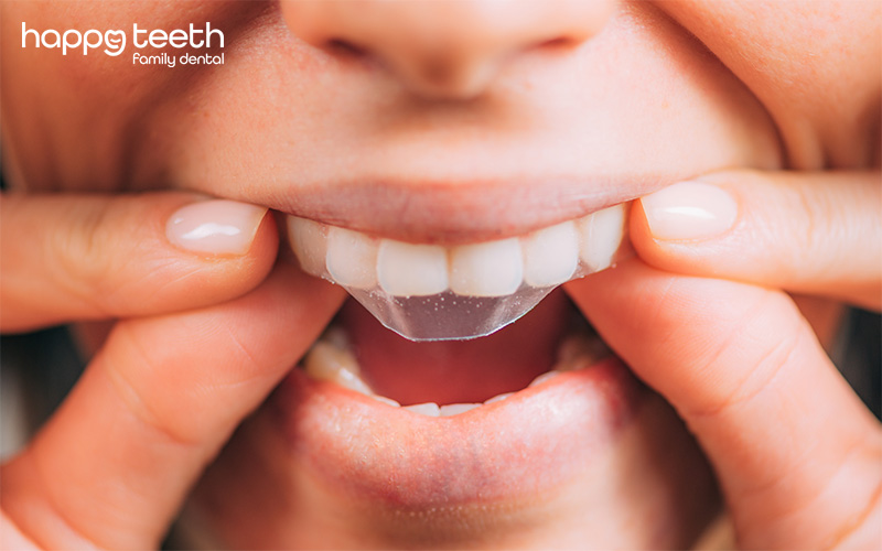 Close up of a person applying a clear whitening strip to their upper teeth Close up of a person applying a clear whitening strip to their upper teeth